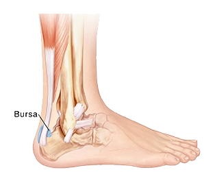Bursa on sale ankle pain