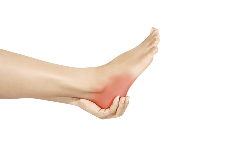 Different Types of a Heel Spur | #1 Podiatry Center | Florida Foot & Ankle